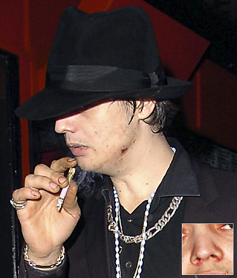 Pete Doherty