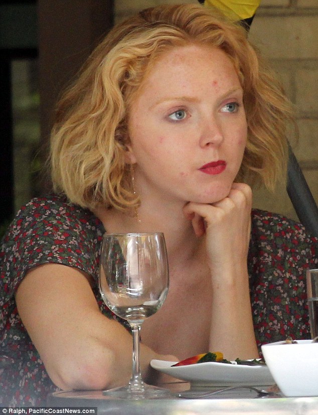 Lily Cole shows supermodels aren’t immune to bad skin days!